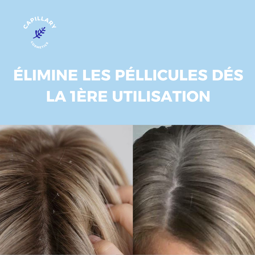 GOMMAGE ANTI-PÉLLICULAIRE
