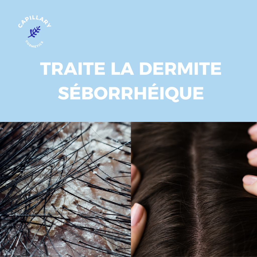 GOMMAGE ANTI-PÉLLICULAIRE